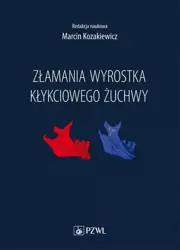 eBook Złamania wyrostka kłykciowego żuchwy - Marcin Kozakiewicz epub mobi