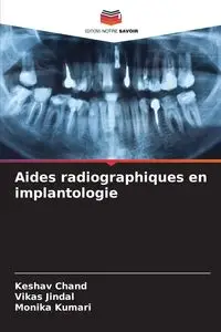 Aides radiographiques en implantologie - Chand Keshav