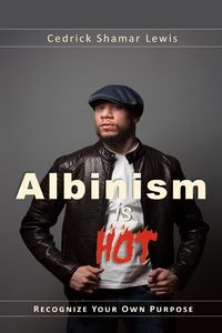 Albinism is Hot! - Lewis Cedrick Shamar