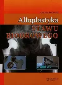 Alloplastyka stawu biodrowego - Andrzej Pozowski