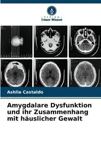 Amygdalare Dysfunktion und ihr Zusammenhang mit häuslicher Gewalt - Ashlie Castaldo