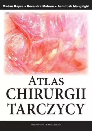 Atlas Chirurgii Tarczycy - Ashutosh Mangalgiri, Devendra Mahore, Madam Kapre