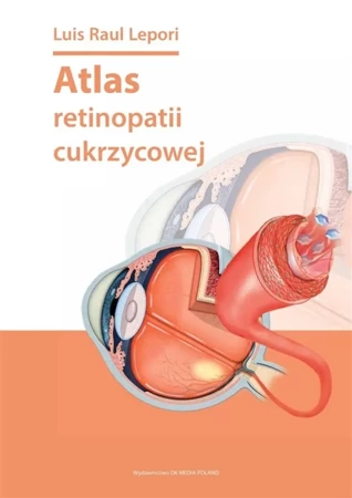 Atlas retinopatii cukrzycowej - Louis Raul Lepori