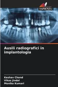 Ausili radiografici in implantologia - Chand Keshav