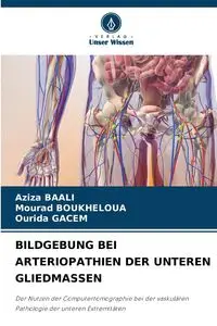 BILDGEBUNG BEI ARTERIOPATHIEN DER UNTEREN GLIEDMASSEN - BAALI Aziza