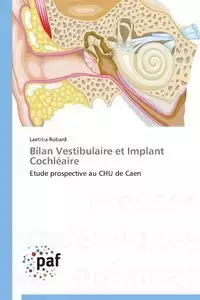 Bilan vestibulaire et implant cochléaire - ROBARD-L