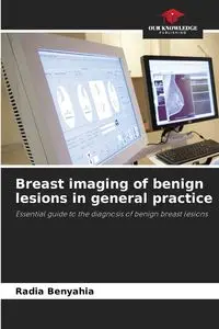 Breast imaging of benign lesions in general practice - BENYAHIA Radia