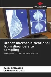 Breast microcalcifications - BENYAHIA Radia