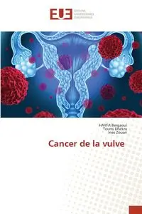 Cancer de la vulve - Bergaoui HAYFA