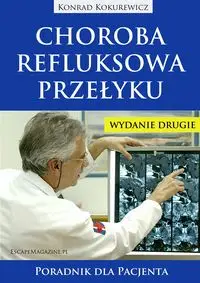 Choroba refluksowa przełyku. Poradnik Wyd.II - Konrad Kokurewicz