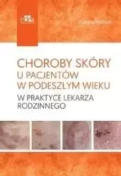 Choroby skóry u pacjentów w podeszłym wieku - Joanna Narbutt