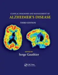 Clinical Diagnosis and Management of Alzheimer's Disease - Gauthier Serge