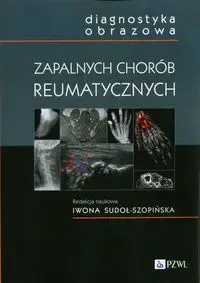 Diagnostyka obrazowa zapalnych chorób reumatycznych - Sudoł-Szopińska  Iwona