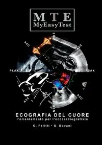 Ecografia del Cuore - MyEasyTest - Giuseppe Felitti