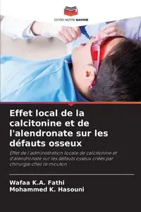 Effet local de la calcitonine et de l'alendronate sur les défauts osseux - Fathi Wafaa K.A.