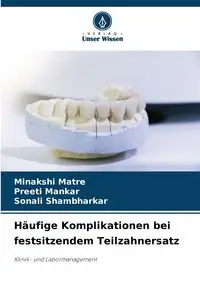 Häufige Komplikationen bei festsitzendem Teilzahnersatz - Matre Minakshi