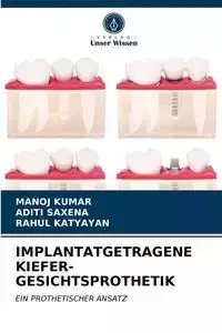 IMPLANTATGETRAGENE KIEFER-GESICHTSPROTHETIK - Kumar Manoj