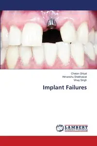 Implant Failures - Ghiyal Chetan