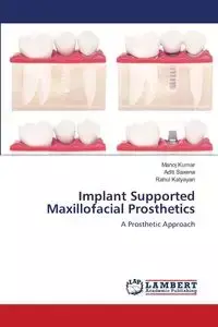 Implant Supported Maxillofacial Prosthetics - Kumar Manoj