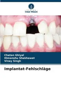 Implantat-Fehlschläge - Ghiyal Chetan