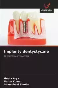 Implanty dentystyczne - Arya Geeta