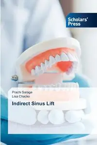 Indirect Sinus Lift - Sarage Prachi