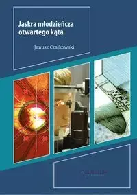 Jaskra młodzieńcza otwartego kąta - Janusz Czajkowski