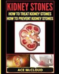 Kidney Stones - McCloud Ace