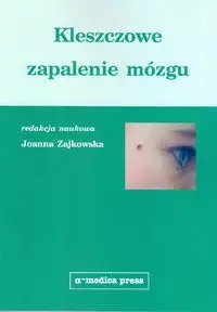 Kleszczowe zapalenie mózgu - Joanna Zajkowska