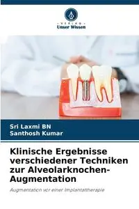 Klinische Ergebnisse verschiedener Techniken zur Alveolarknochen-Augmentation - BN Sri Laxmi