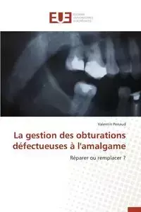 La gestion des obturations défectueuses à l'amalgame - PENAUD-V