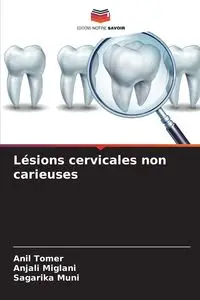 Lésions cervicales non carieuses - Tomer Anil