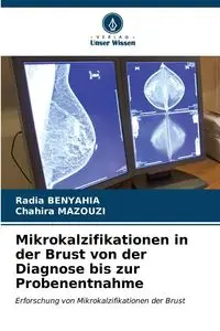 Mikrokalzifikationen in der Brust von der Diagnose bis zur Probenentnahme - BENYAHIA Radia