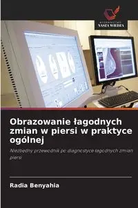 Obrazowanie łagodnych zmian w piersi w praktyce ogólnej - BENYAHIA Radia