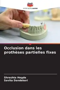 Occlusion dans les prothèses partielles fixes - Hegde Shreshta