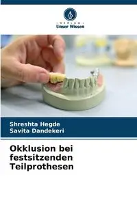 Okklusion bei festsitzenden Teilprothesen - Hegde Shreshta