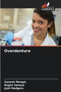 Overdenture - Mengal Ganesh