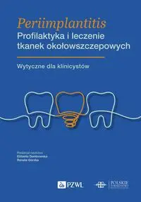 Periimplantitis Profilaktyka i leczenie tkanek okołowszczepowych - Elżbieta Dembowska, Renata Górska