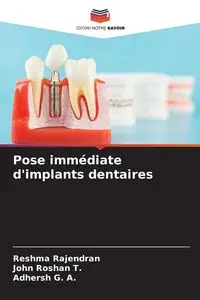 Pose immédiate d'implants dentaires - Rajendran Reshma