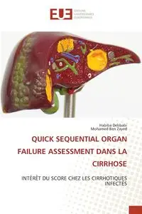 QUICK SEQUENTIAL ORGAN FAILURE ASSESSMENT DANS LA CIRRHOSE - Debbabi Habiba