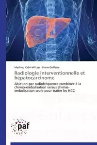 Radiologie interventionnelle et hépatocarcinome - Collectif