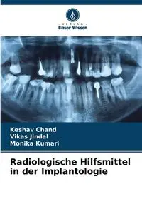 Radiologische Hilfsmittel in der Implantologie - Chand Keshav