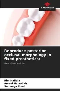 Reproduce posterior occlusal morphology in fixed prosthetics - Kallala Rim