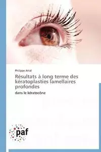 Résultats à long terme des kératoplasties lamellaires profondes - ATTAL-P