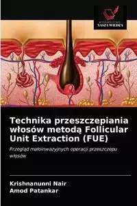 Technika przeszczepiania włosów metodą Follicular Unit Extraction (FUE) - Nair Krishnanunni