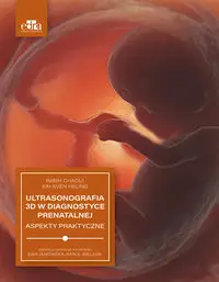 Ultrasonografia 3D w diagnostyce prenatalnej - R. Chaoui