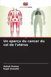 Un aperçu du cancer du col de l'utérus - Kumar Ashok