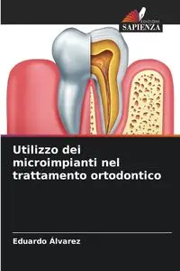 Utilizzo dei microimpianti nel trattamento ortodontico - Eduardo Álvarez