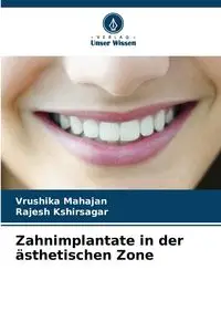 Zahnimplantate in der ästhetischen Zone - Mahajan Vrushika