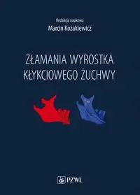 Złamania wyrostka kłykciowego żuchwy - Marcin Kozakiewicz